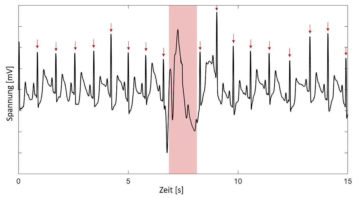 [Translate to 日本:] Fig.3: Artifacts in the EDA signal