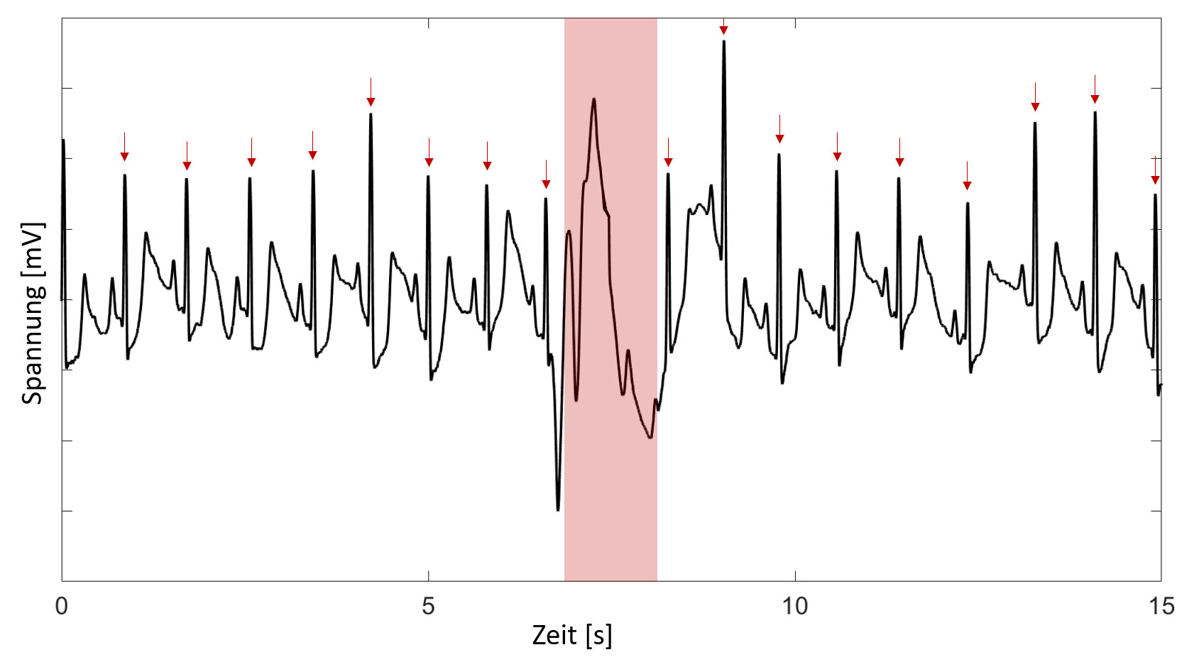 [Translate to German:] Fig.3: Artifacts in the EDA signal